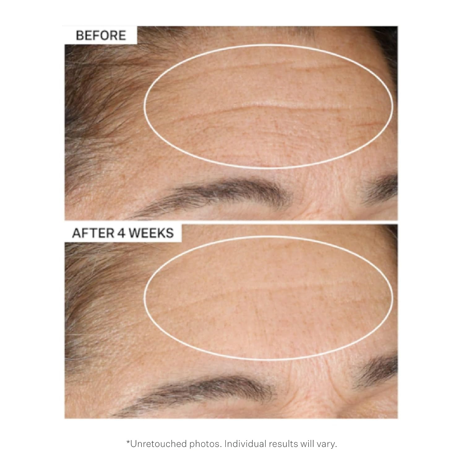 image:imageStriVectin Advanced Retinol Targets Visible Signs of Aging for Healthier SkinAdvanced Retinol Intensive Night Moisturizer 17 oz