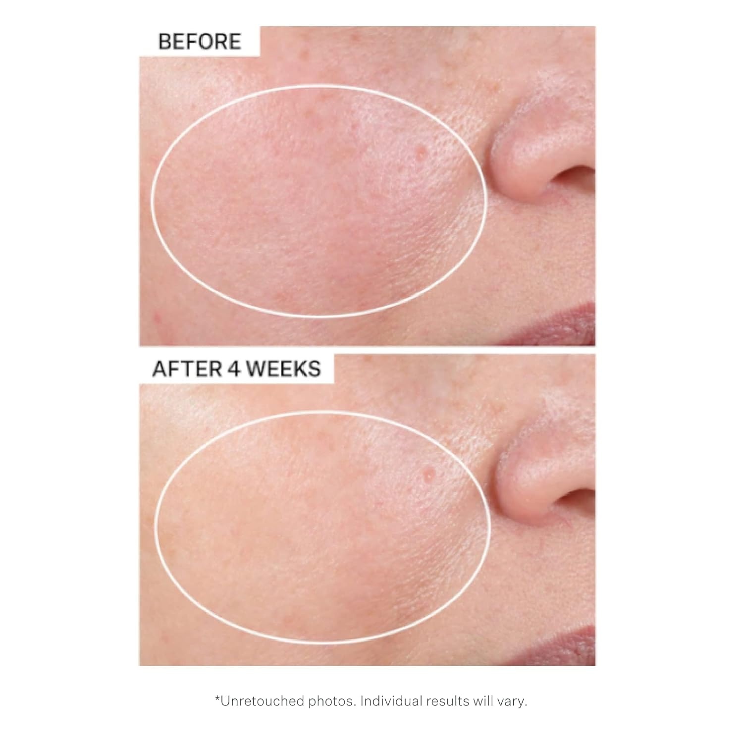 image:imageStriVectin Advanced Retinol Targets Visible Signs of Aging for Healthier SkinAdvanced Retinol Intensive Night Moisturizer 17 oz