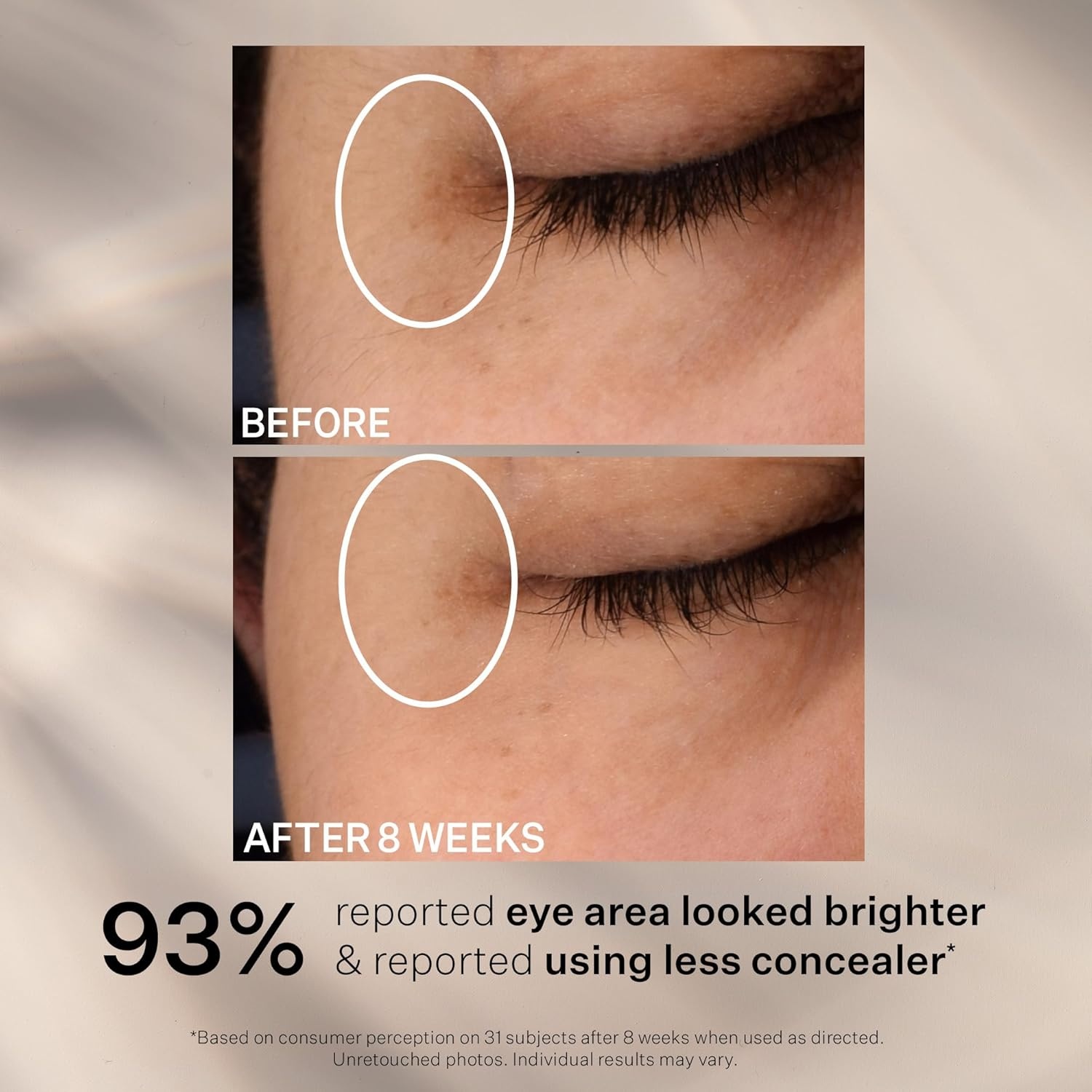 image:imageStriVectin SuperC Eye Vitamin C Eye Cream Brightening and Firming Boost Skin Dullness with Hyaluronic Acid05 Fl Oz Pack of 1