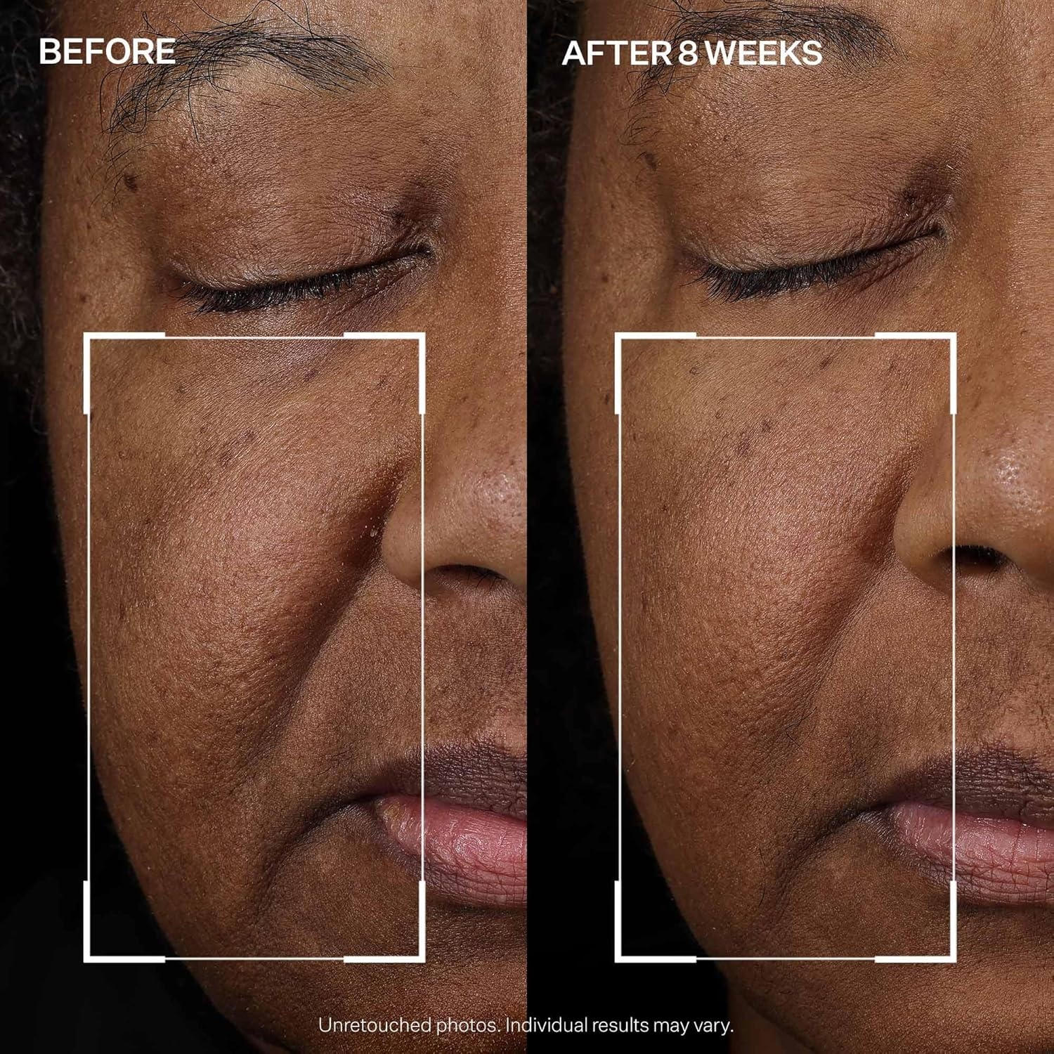 image:imageStriVectin Tighten amp Lift Peptight Face Lift Serum with Tightening amp Brightening Peptides for WrinklesPeptight Face Lift Serum 30 ml