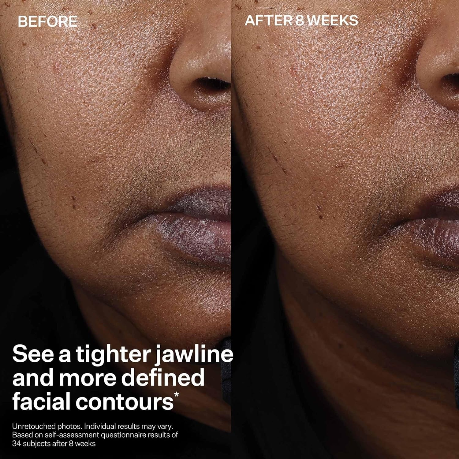 image:imageStriVectin Tighten amp Lift Peptight Face Lift Serum with Tightening amp Brightening Peptides for WrinklesPeptight Face Lift Serum 30 ml