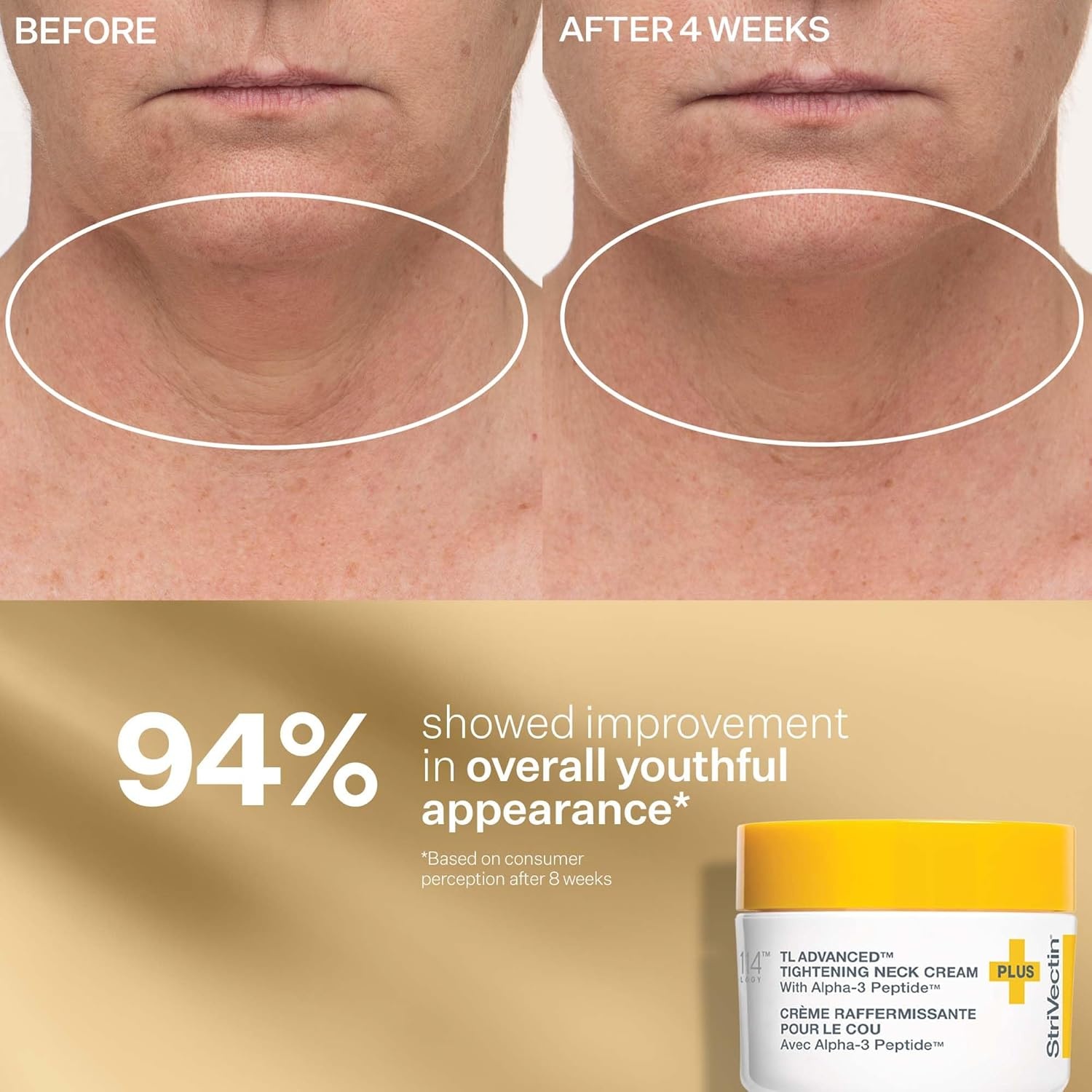 image:imageStriVectin Tighten amp Lift Peptight Face Lift Serum with Tightening amp Brightening Peptides for WrinklesPeptight Power Starters Trio Kit 3 piece Kit for Face Eyes and Neck