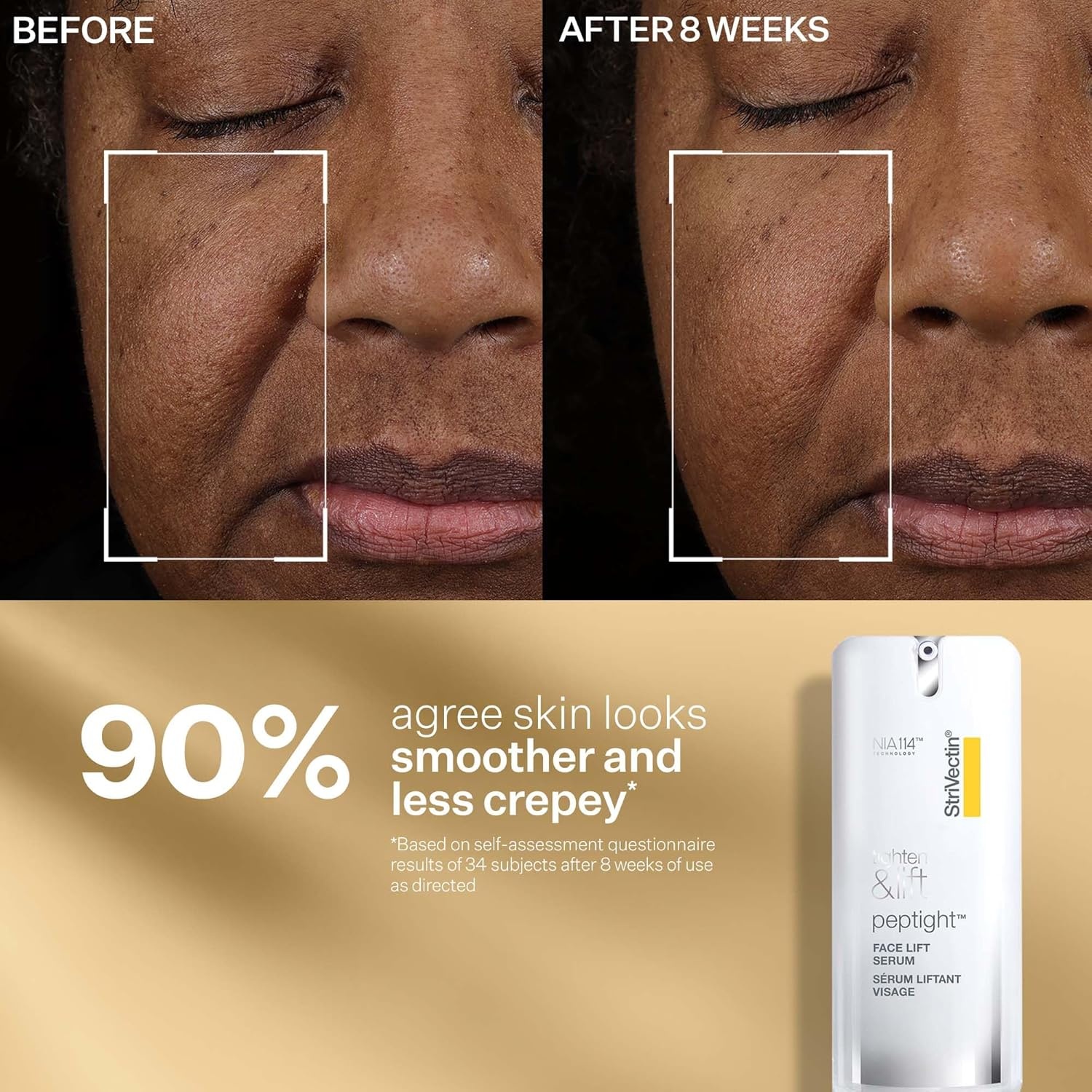 image:imageStriVectin Tighten amp Lift Peptight Face Lift Serum with Tightening amp Brightening Peptides for WrinklesPeptight Power Starters Trio Kit 3 piece Kit for Face Eyes and Neck
