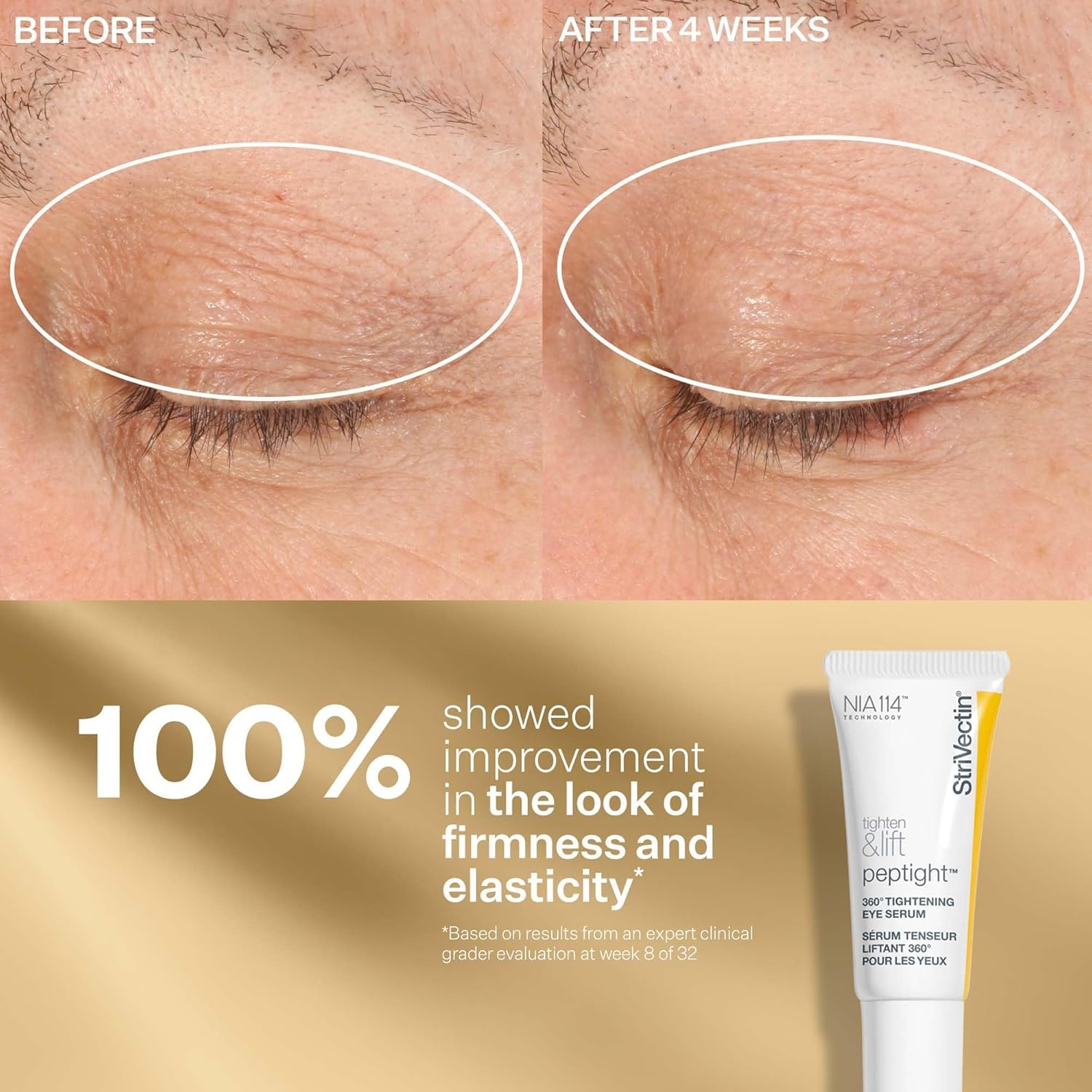 image:imageStriVectin Tighten amp Lift Peptight Face Lift Serum with Tightening amp Brightening Peptides for WrinklesPeptight Power Starters Trio Kit 3 piece Kit for Face Eyes and Neck