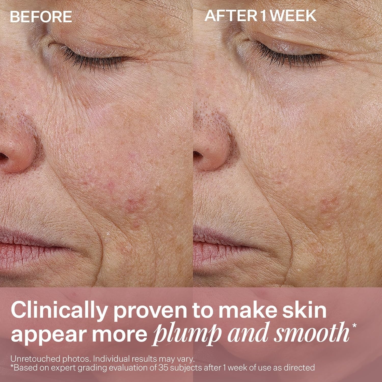 image:imageStriVectin AntiWrinkle Peptide Plump Line Filling Bounce Face Serum with Ceramides amp Peptides for Firm Skin and Less Wrinkles amp Fine Lines17 Ounce Pack of 1