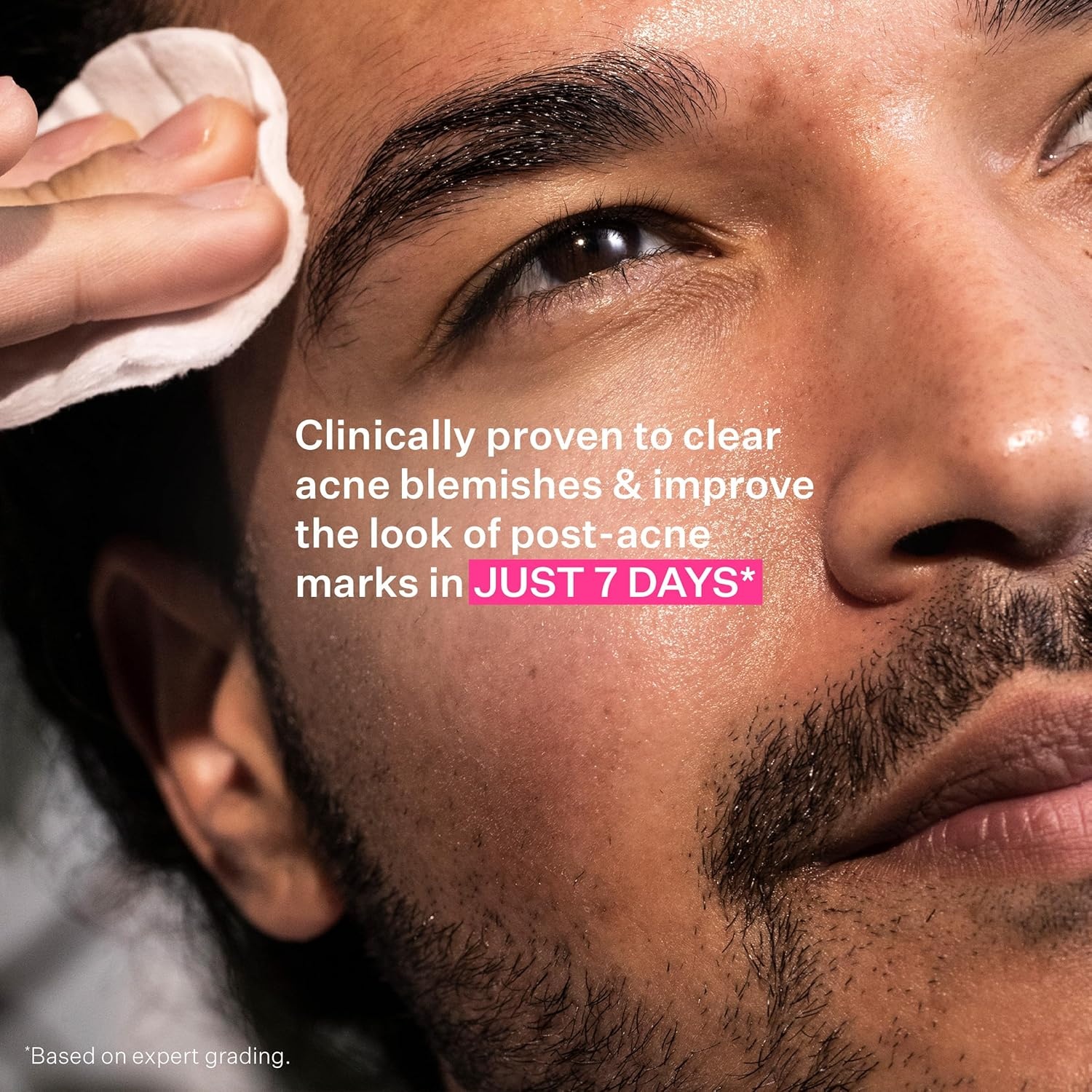image:imageStriVectin Multi Action Clear for Acne and Blemish Prone Skin for Clearer Smooth and Brighter Skin Less Breakouts and Pimples for Healthy Looking SkinMulti Action Clear Acne 30 day 3 Piece Trial Kit