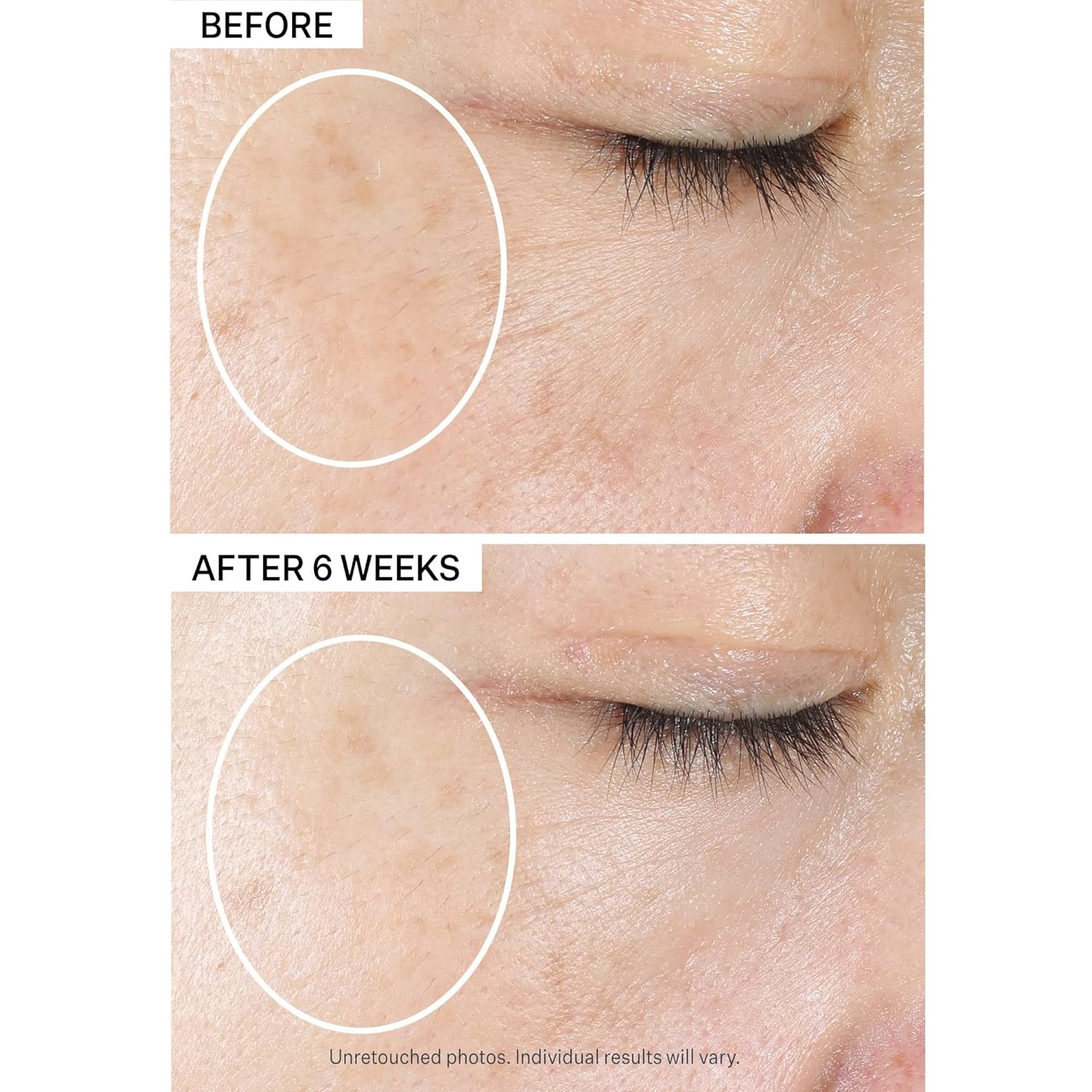image:imageStriVectin MultiAction SuperC Vitamin C Moisturizer Brightening and Smoothing Fine Lines 17 Fl Oz17 Fl Oz Pack of 1