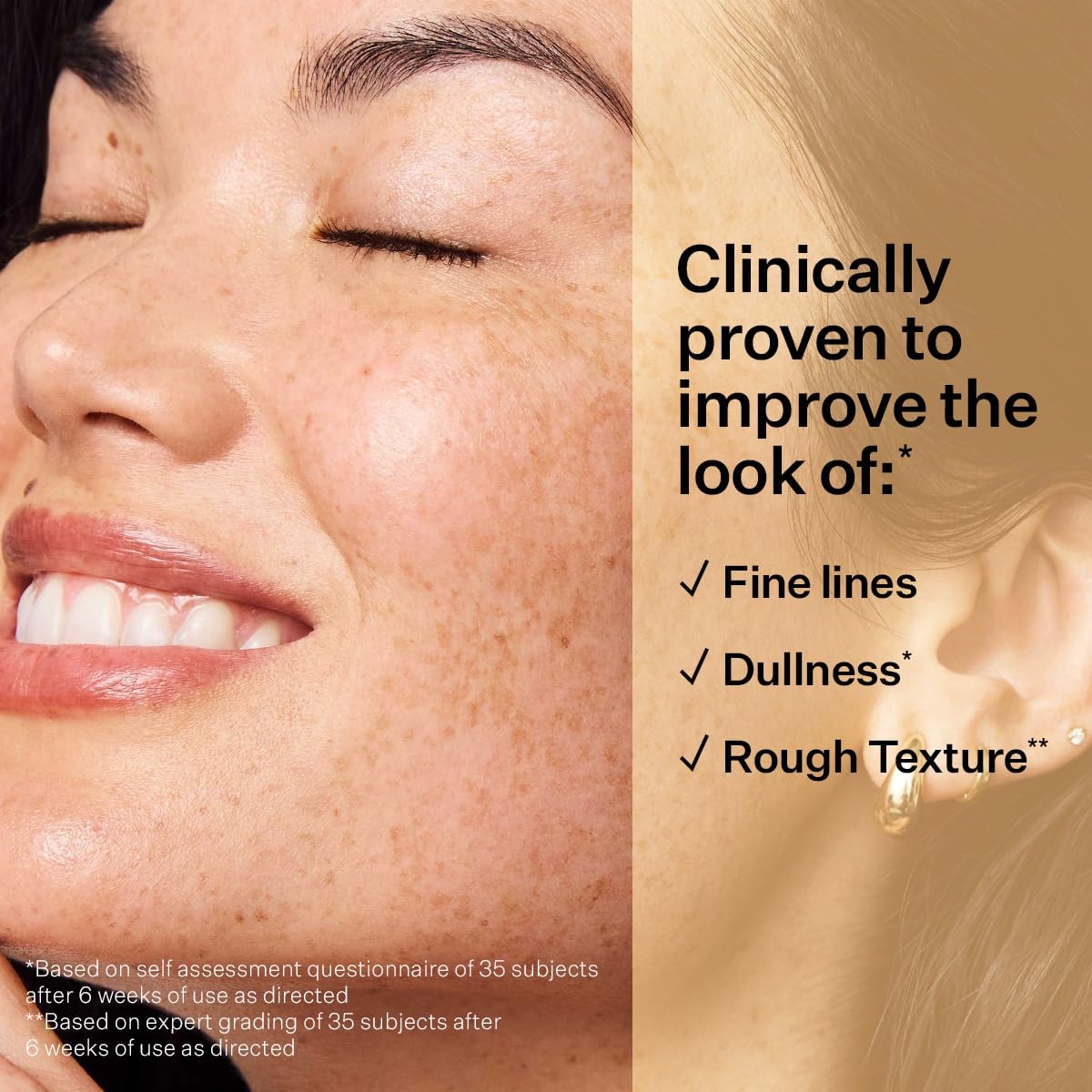 image:imageStriVectin SuperC Retinol Brighten amp Correct Vitamin C Serum Antioxidant Face Serum for Uneven Tone Fine Lines and Firmness Drops for Face1 Fl Oz Pack of 1