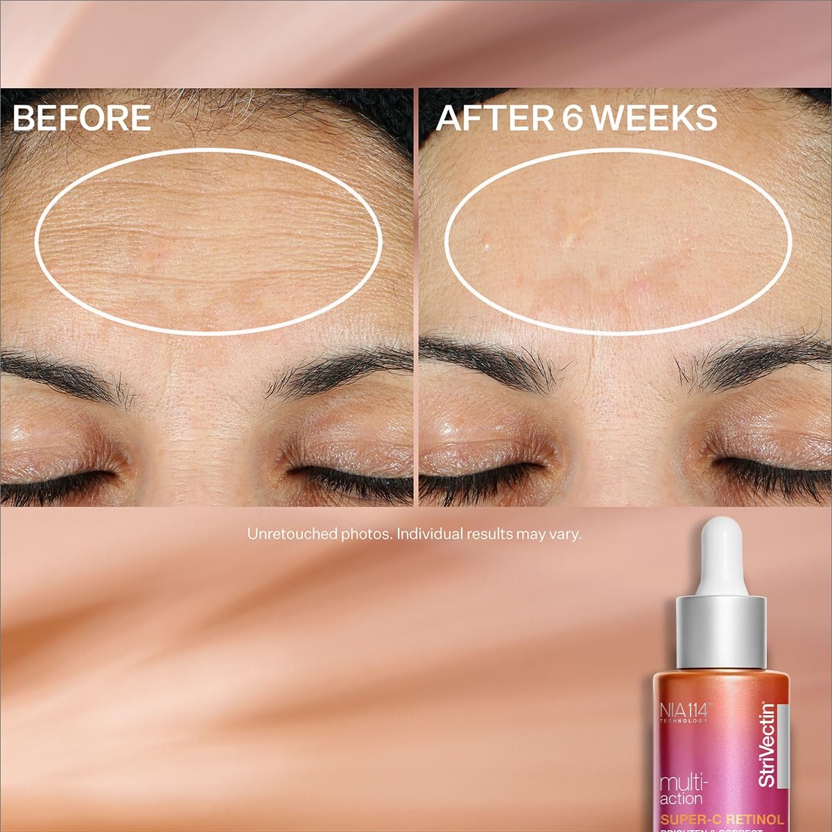 image:imageStriVectin SuperC Retinol Brighten amp Correct Vitamin C Serum Antioxidant Face Serum for Uneven Tone Fine Lines and Firmness Drops for Face1 Fl Oz Pack of 1