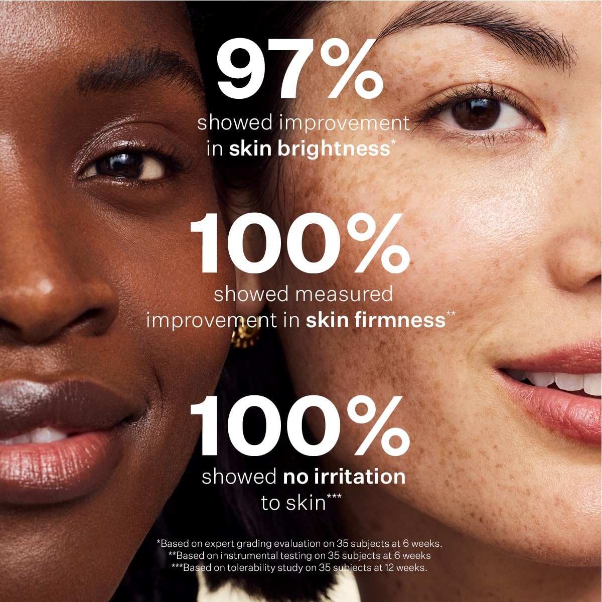 image:imageStriVectin SuperC Retinol Brighten amp Correct Vitamin C Serum Antioxidant Face Serum for Uneven Tone Fine Lines and Firmness Drops for Face1 Fl Oz Pack of 1