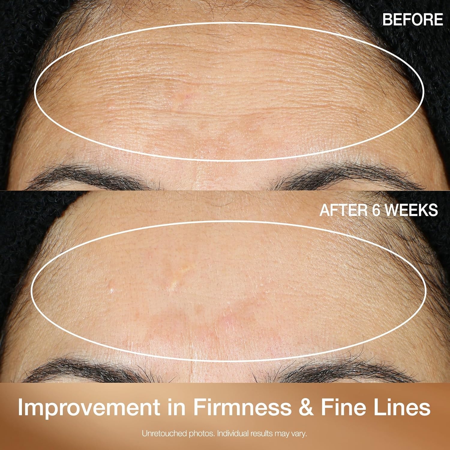image:imageStriVectin SuperC Retinol Brighten amp Correct Vitamin C Serum Antioxidant Face Serum for Uneven Tone Fine Lines and Firmness Drops for Face17 Ounce Pack of 1