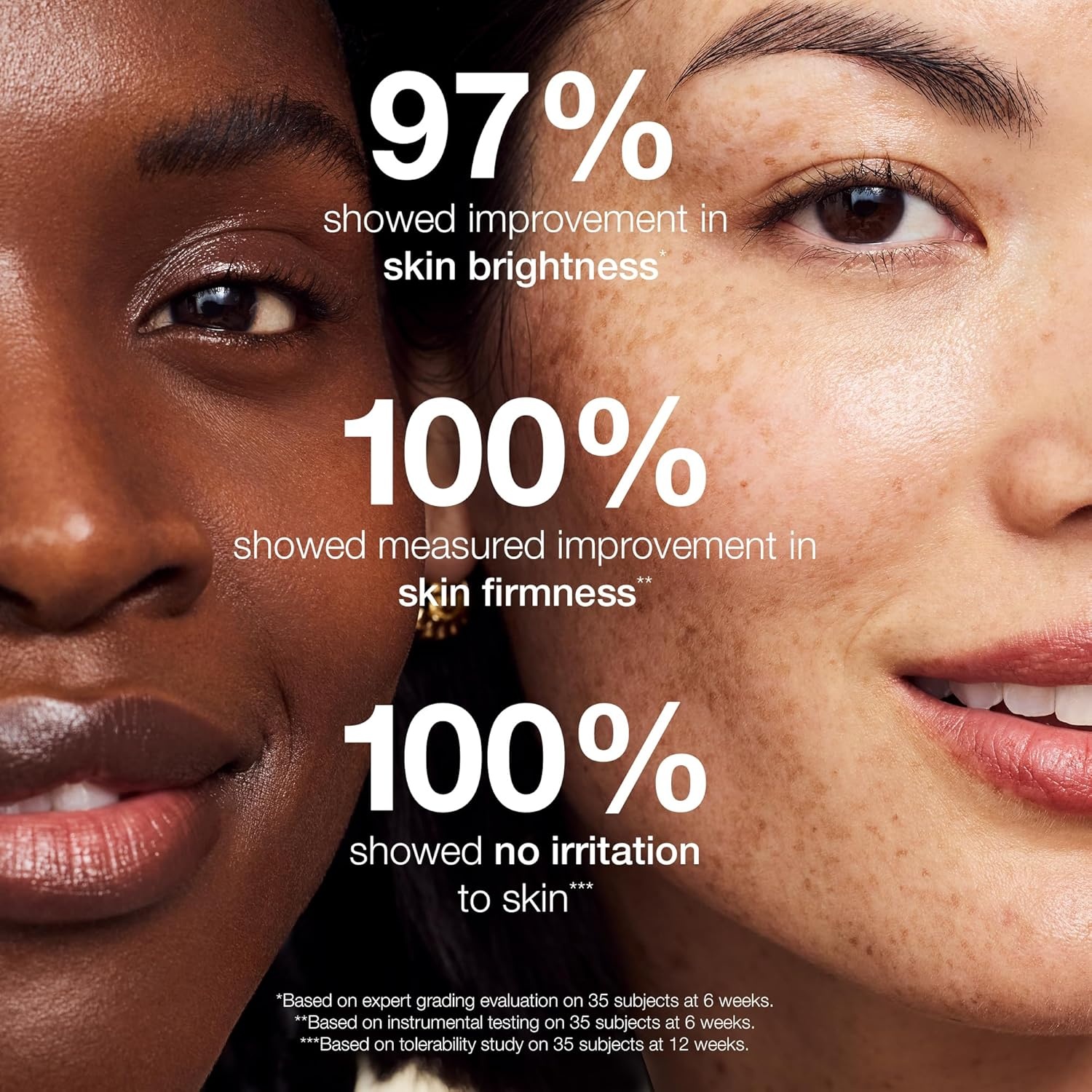 image:imageStriVectin SuperC Retinol Brighten amp Correct Vitamin C Serum Antioxidant Face Serum for Uneven Tone Fine Lines and Firmness Drops for Face17 Ounce Pack of 1