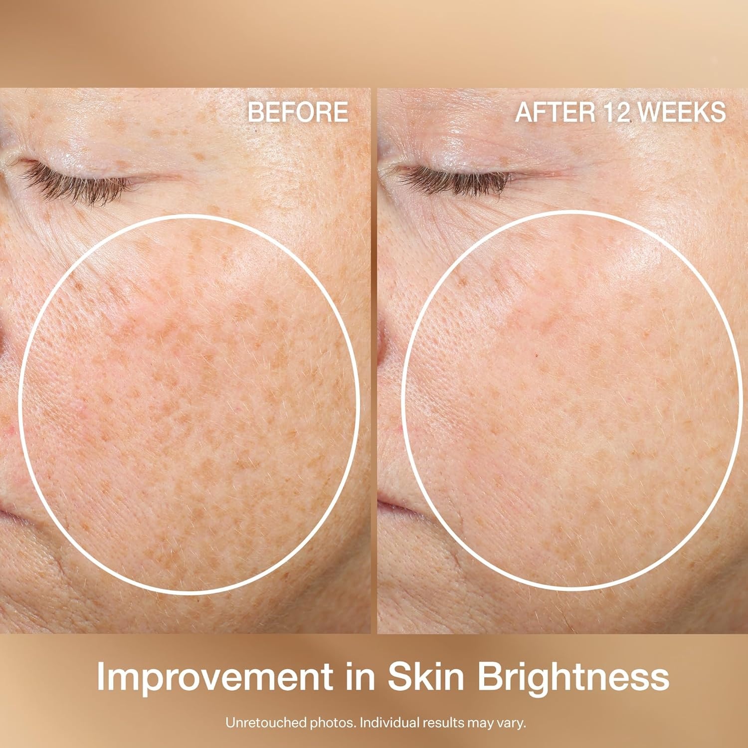 image:imageStriVectin SuperC Retinol Brighten amp Correct Vitamin C Serum Antioxidant Face Serum for Uneven Tone Fine Lines and Firmness Drops for Face17 Ounce Pack of 1